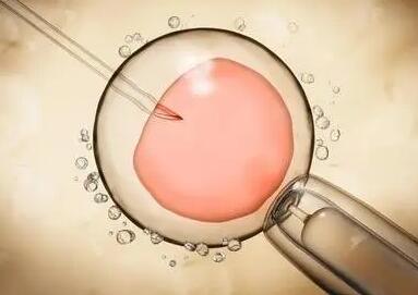 试管婴儿移植鲜胚还是冻胚，应该怎么选择